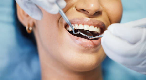 Best Emergency Wisdom Teeth Removal in Monroe, OH